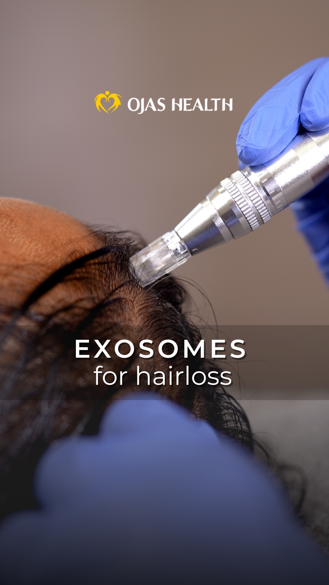 Exosome-based scalp treatment reference image