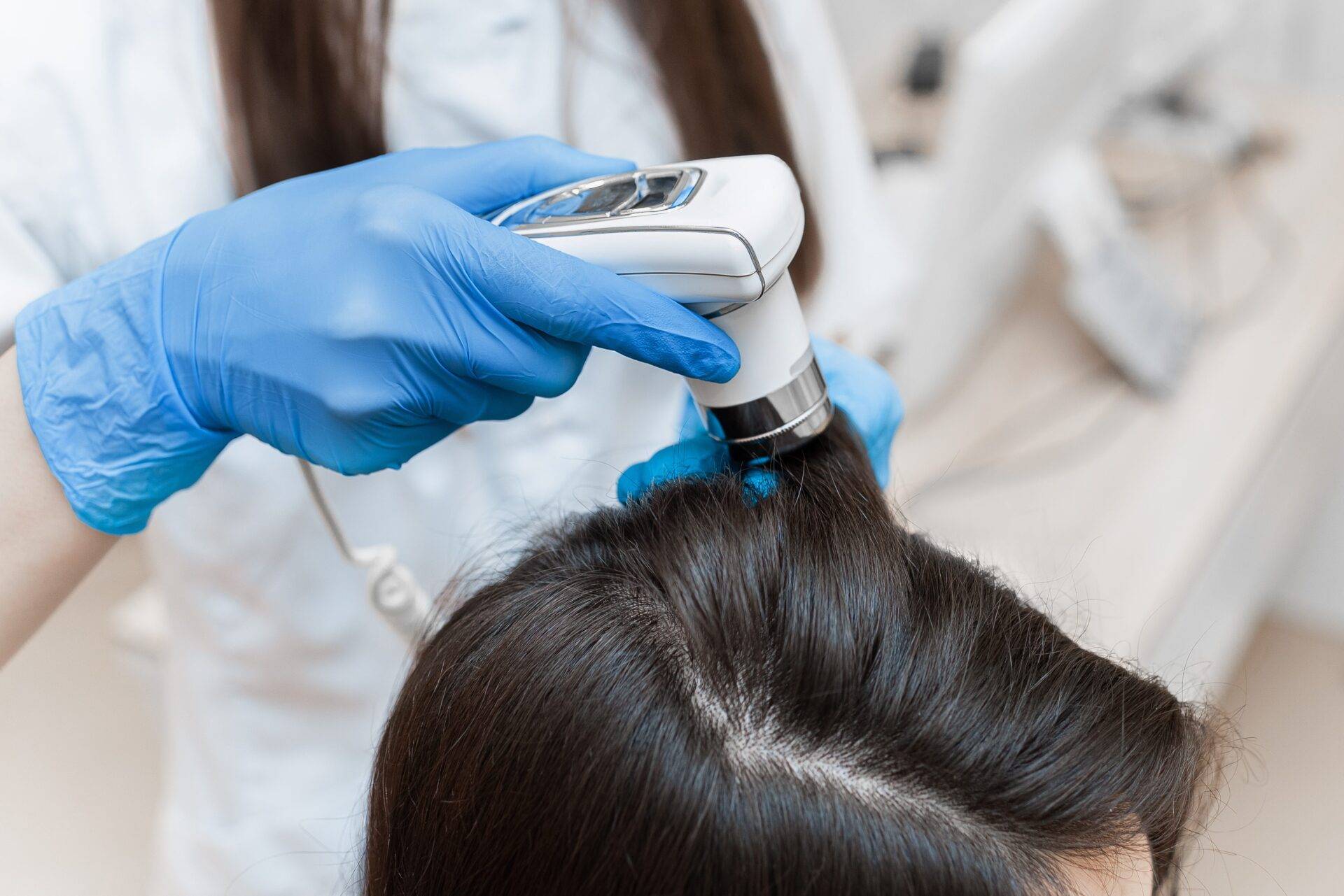 Dermatologist examining the scalp to diagnose hair fall