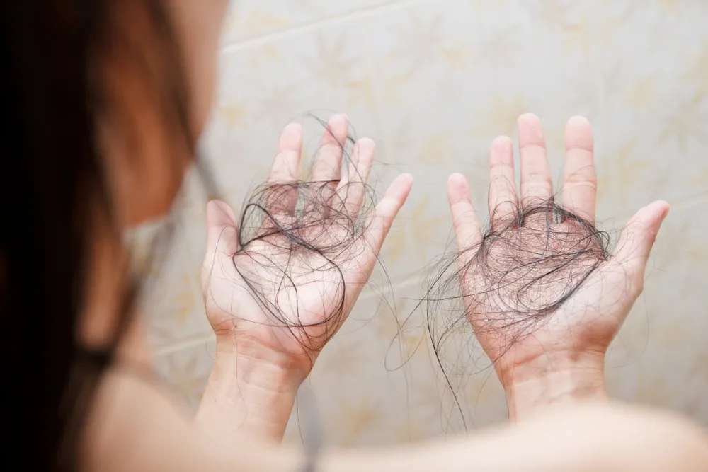 Laboratory investigation for nutritional deficiencies such as Vitamin B12 linked to hair loss