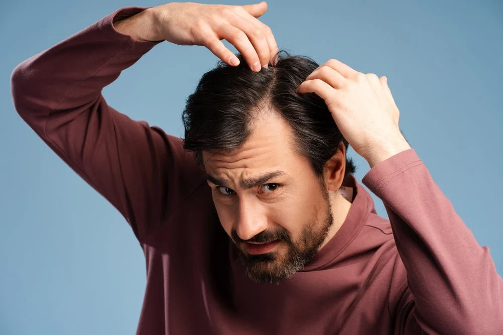 Common causes of hair fall including genetics, hormones, and nutritional deficiencies