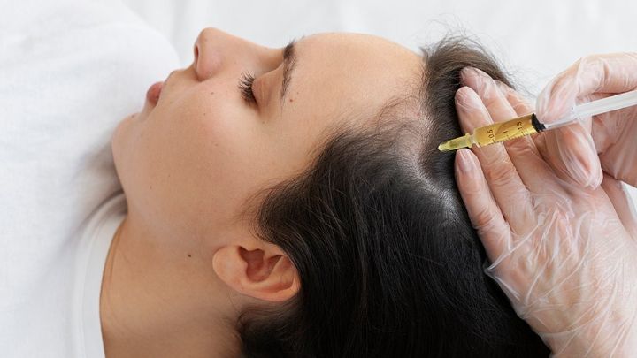 GFC hair treatment and growth factor concentrate therapy