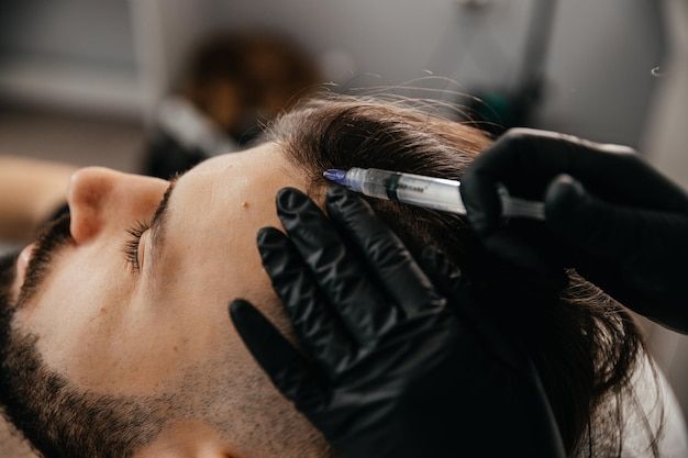 Mesotherapy injections being used in a hair treatment setting