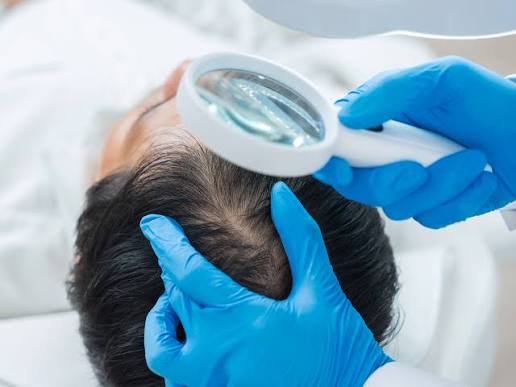 Doctor evaluating the underlying causes of hair loss